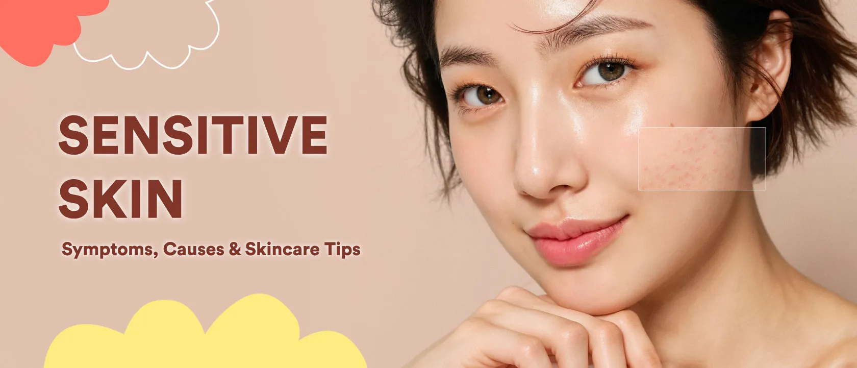 Sensitive Skin: Symptoms, Causes & Skincare Tips